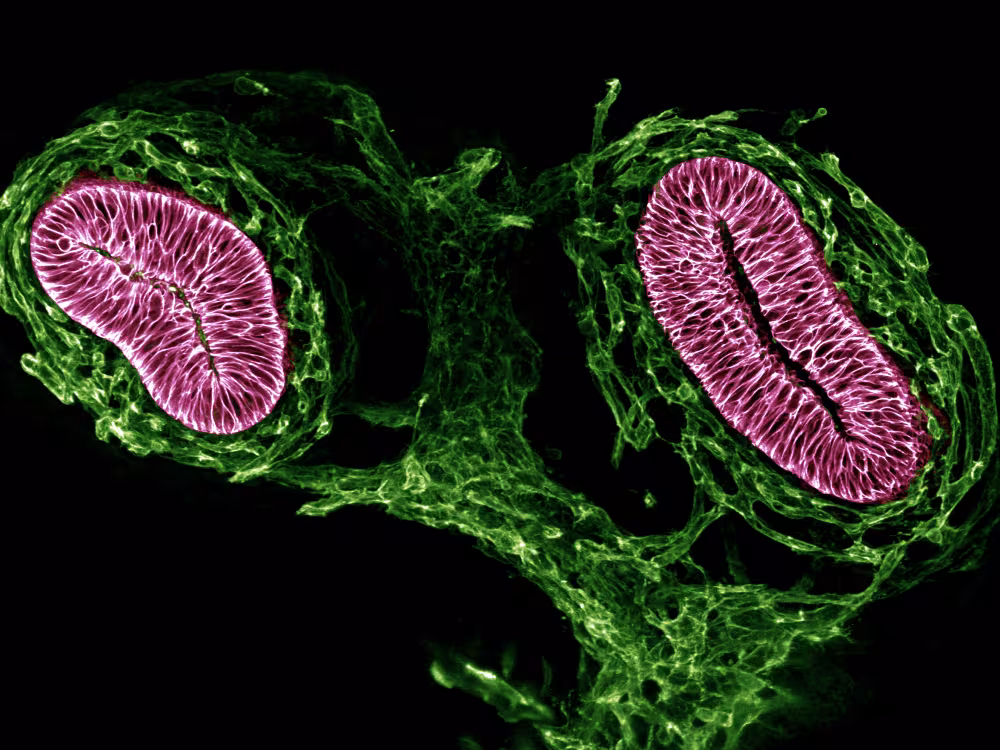 green and pink patterns on black background